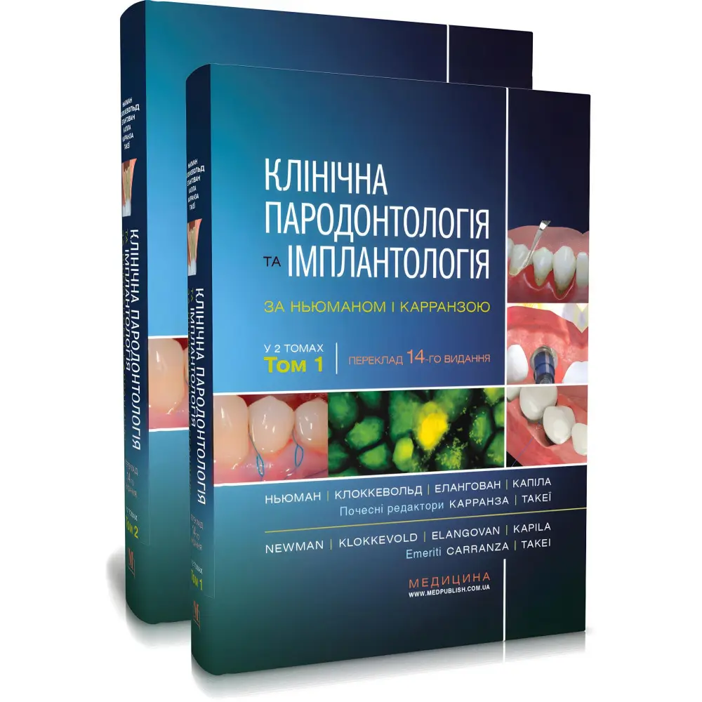 Клінічна пародонтологія та імплантологія за Ньюманом і Карранзою: 14-е видання: в 2-х томах / Майкл Г. Ньюман, Перрі Р. Клоккевольд, Сатіш Елангован та ін. Клінічна пародонтологія та імплантологія за Ньюманом і Карранзою: 14-е видання: в 2-х томах / Майкл Г. Ньюман, Перрі Р. Клоккевольд, Сатіш Елангован та ін.
