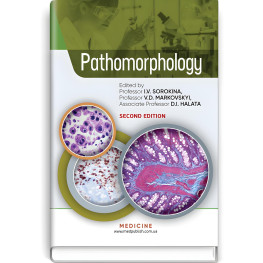  Pathomorphology: textbook / I.V. Sorokina, V.D. Markovskyi, D.I. Halata et al. — 2nd edition